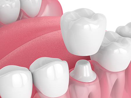 The image displays a close-up graphic of multiple white teeth set against a pink background with a watermark text overlay.