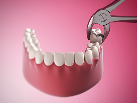 The image shows a pair of scissors cutting into a set of teeth with visible enamel wear, placed on a pink background.
